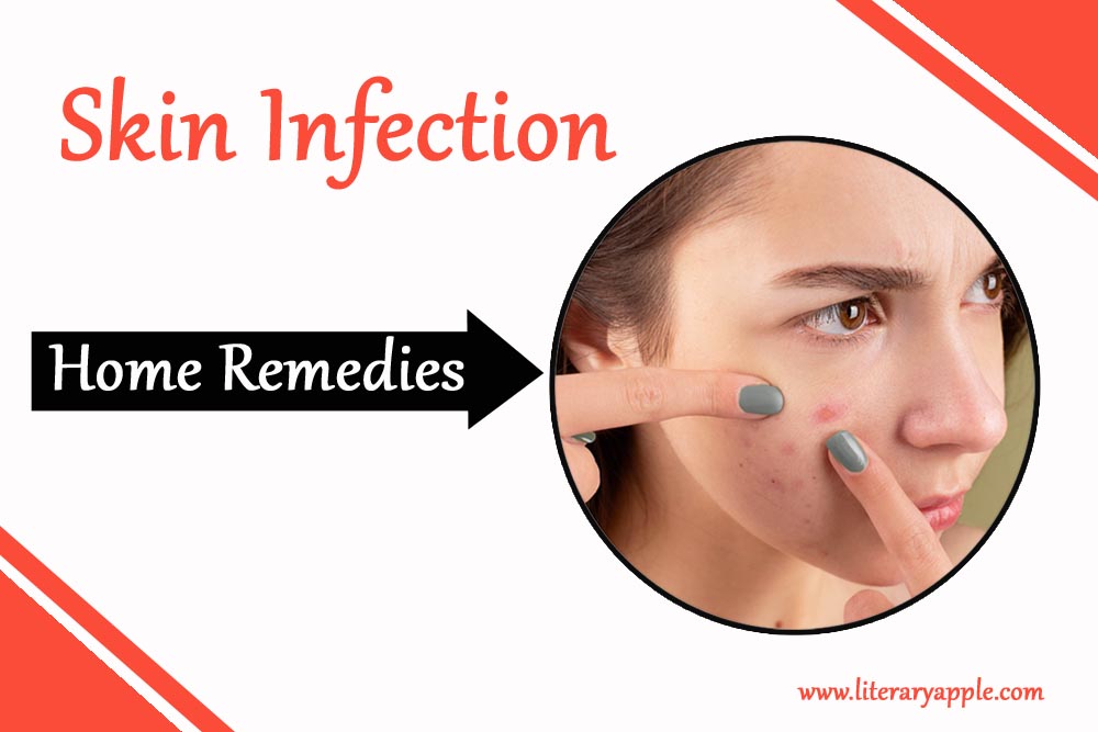 home-remedies-to-treat-skin-infections-literary-apple