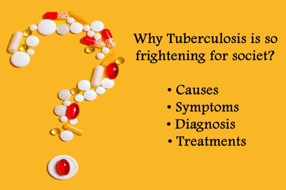 Tuberculosis why it is so frightening so society