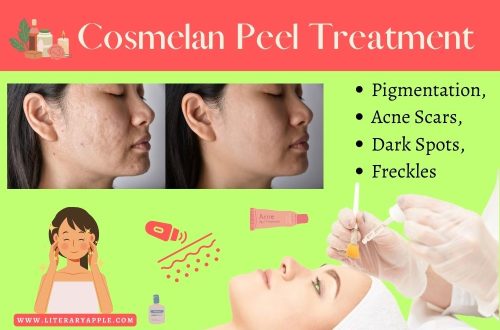 Cosmelan Peel Treatment