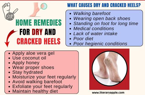 Home Remedies for Dry and Cracked Heels