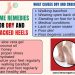 Home Remedies for Dry and Cracked Heels