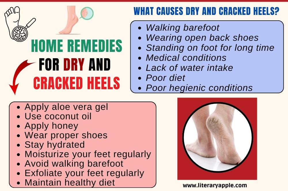 Home Remedies For Dry And Cracked Heels - Literary Apple