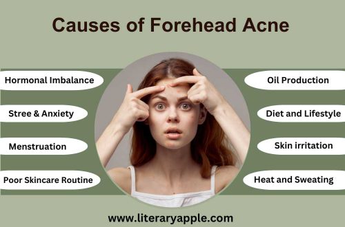 Forehead Acne: Causes and Treatments