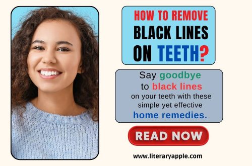 How to Remove Black Lines on Teeth